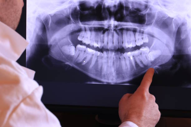 Best 24-Hour Emergency Dental Care in Forsyth, IL