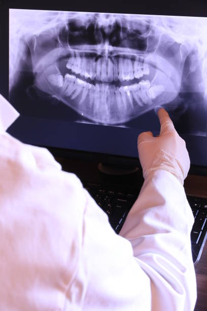 Best Dental Abscess Treatment in Forsyth, IL