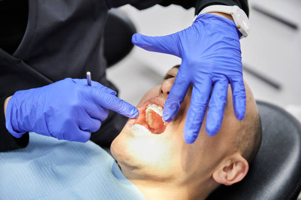 Best Knocked-Out Tooth (Avulsed Tooth) Treatment in Forsyth, IL